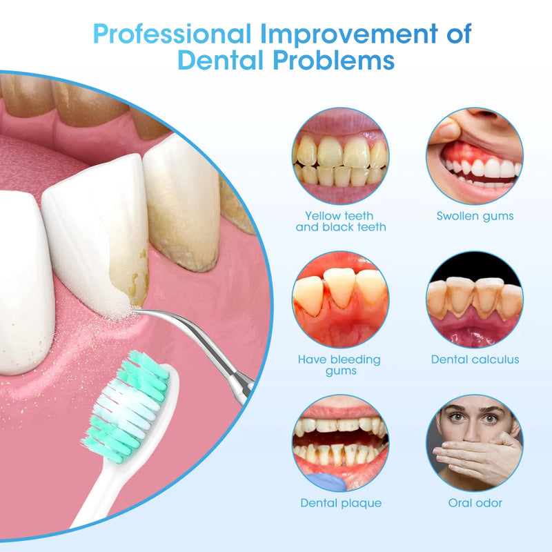 Electric Teeth Whitening - Calculus  Plaque - Coffee Stain - Tartar Removal - Martsgaia